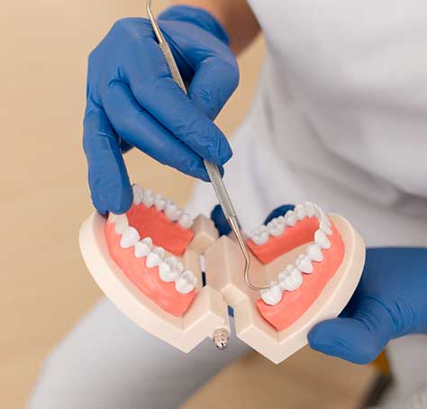 implantes-carga-inmediata-markina-fuldain