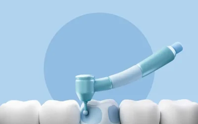 ¿Qué problemas dentales puede traer el sarro?